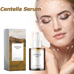 Centella Calming Serum — K-Beauty Glass Skin Essential